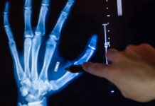 Biohacking: Are you ready for an RFID chip? biohacking rfid chip