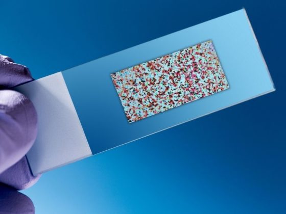 Can a DNA test be wrong? [5 reasons you should be aware of] - Digital ...