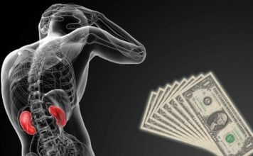 How much is a Kidney worth? how much is a kidney worth main